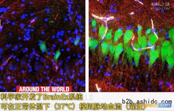 美国科学家成功复活了猪的大脑，死亡的大脑有复活的可能