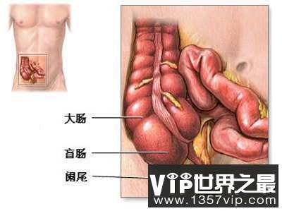 阑尾有什么作用 并非完全没用