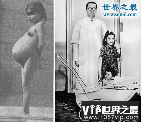 世界上最大的婴儿，出生既37斤(等同于6岁孩子体重)(www.1357vip.com)