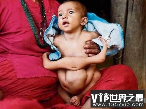 世界上腿最多的女人，四腿女子如何过性生活(www.1357vip.com)