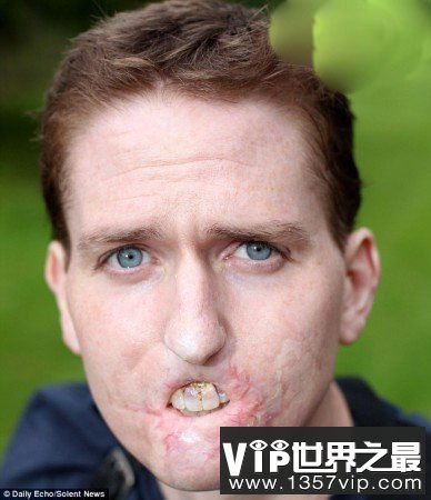 世界上最恶心的人，又丑又恶心的男人和女人（图片）