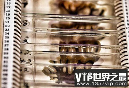 世界十大恐怖之地：神秘医学博物馆穆特博物馆