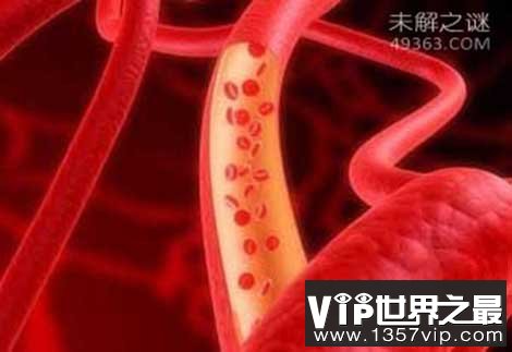 科学家揭秘：人类基因是肢体再生的关键