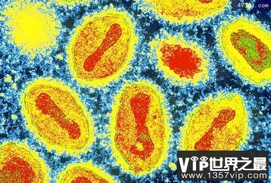 造成5亿人的死亡天花病毒有多可怕?80年代人类宣布消灭它