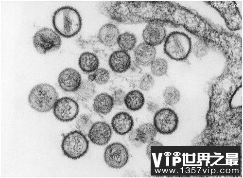 人类历史上12种最致命病毒，冠状病毒上榜