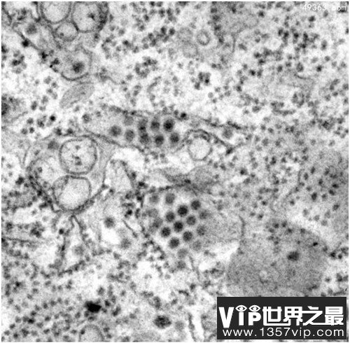 人类历史上12种最致命病毒，冠状病毒上榜