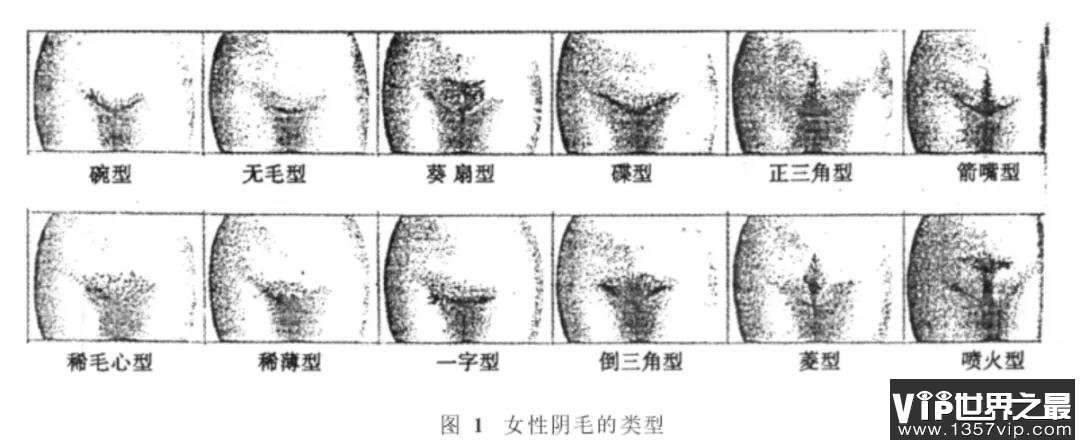 私处毛毛的疏密