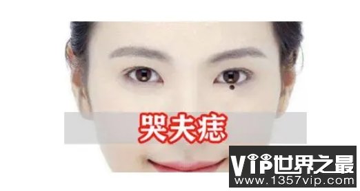 女人痣长在哪里最有福气最富贵?