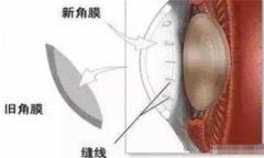 猪皮可以做眼膜吗（可以）